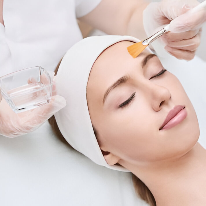 Tratamiento Facial con Peeling Médico
